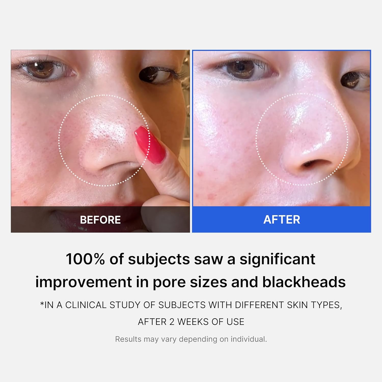 Medicube Zero Pore Pads 2.0, Dual-Textured Facial Toner Pads for Exfoliation and Pore Care with 4.5% AHA Lactic Acid & 0.45% BHA Salicylic Acid, Ideal for All Skin Types, Korean Skin Care (70 Pads) image 4