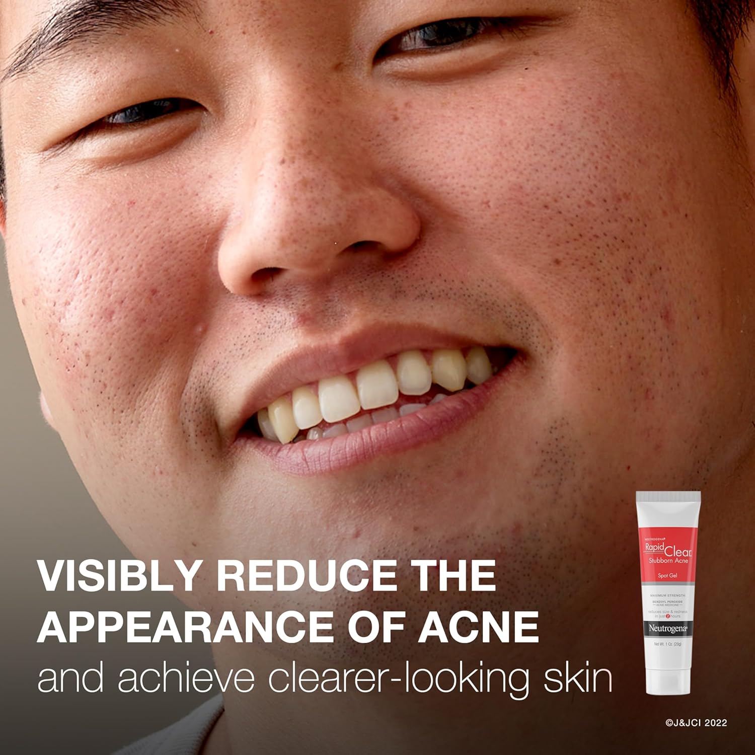 Neutrogena Rapid Clear Stubborn Acne Spot Treatment Gel, Maximum Strength 10% Benzoyl Peroxide Treatment Medication for Acne Prone Skin, Pimple Cream Reduces Size & Redness in 2 Hours, 1 oz image 3
