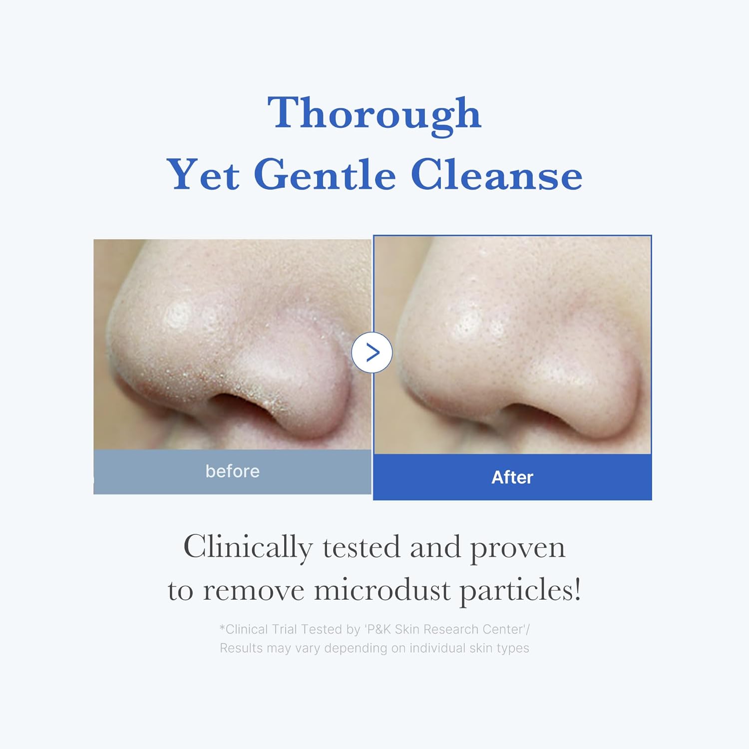 medicube Zero Foam Cleanser for Sensitive Skin - Sebum Control, Moisture Balance, and Pore Minimization | Korean Skincare image 3